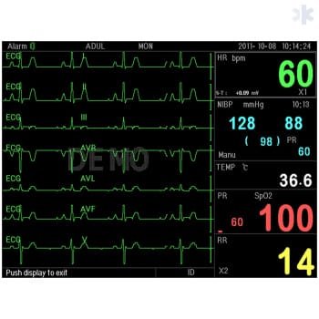 Monitor de sinais vitais PC-3000 - Image 5